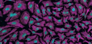 iso 20387:2018 biobanking et Euro-Quality System