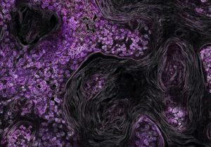 national-cancer-institute-zoFbfT0M_BU-unsplash_2