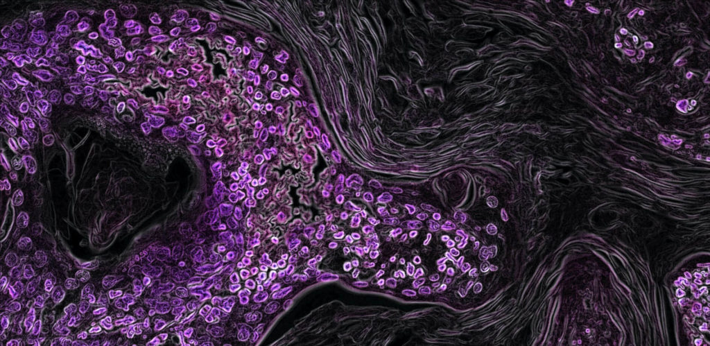 national-cancer-institute-zoFbfT0M_BU-unsplash_1