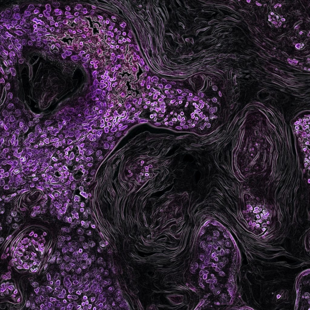 national-cancer-institute-zoFbfT0M_BU-unsplash_2
